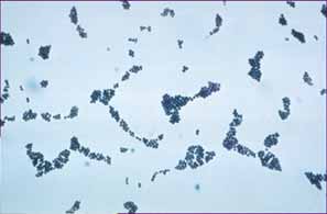 Viruses Partículas pequeñas que viven y se replican dentro de un hospedero