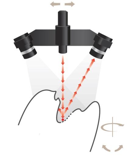 El software correspondiente a los escáneres de 3Shape permite realizar los siguientes tipos de trabajos: Coronas individuales Puentes de 2 a 14 dientes Coronas telescópicas Estructuras para prótesis