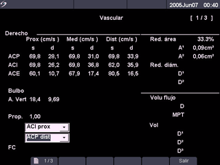Informes de pacientes Figura 14 Informes vascular y cardíaco del paciente Informes de pacientes 1 Pulse la tecla Infor.