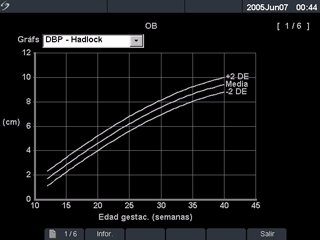 Figura 16 Gráficos obstétricos Gráficos obstétricos Nota: Puede que los gráficos obstétricos sólo se puedan visualizar cuando se haya introducido el UPM o la FP esta.