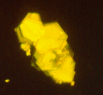 Foto 9 Macla gigante (oc. x7, obj. x20, luz polarizada) compuesta en estratos o escalera característica de los cristales de Cistina.