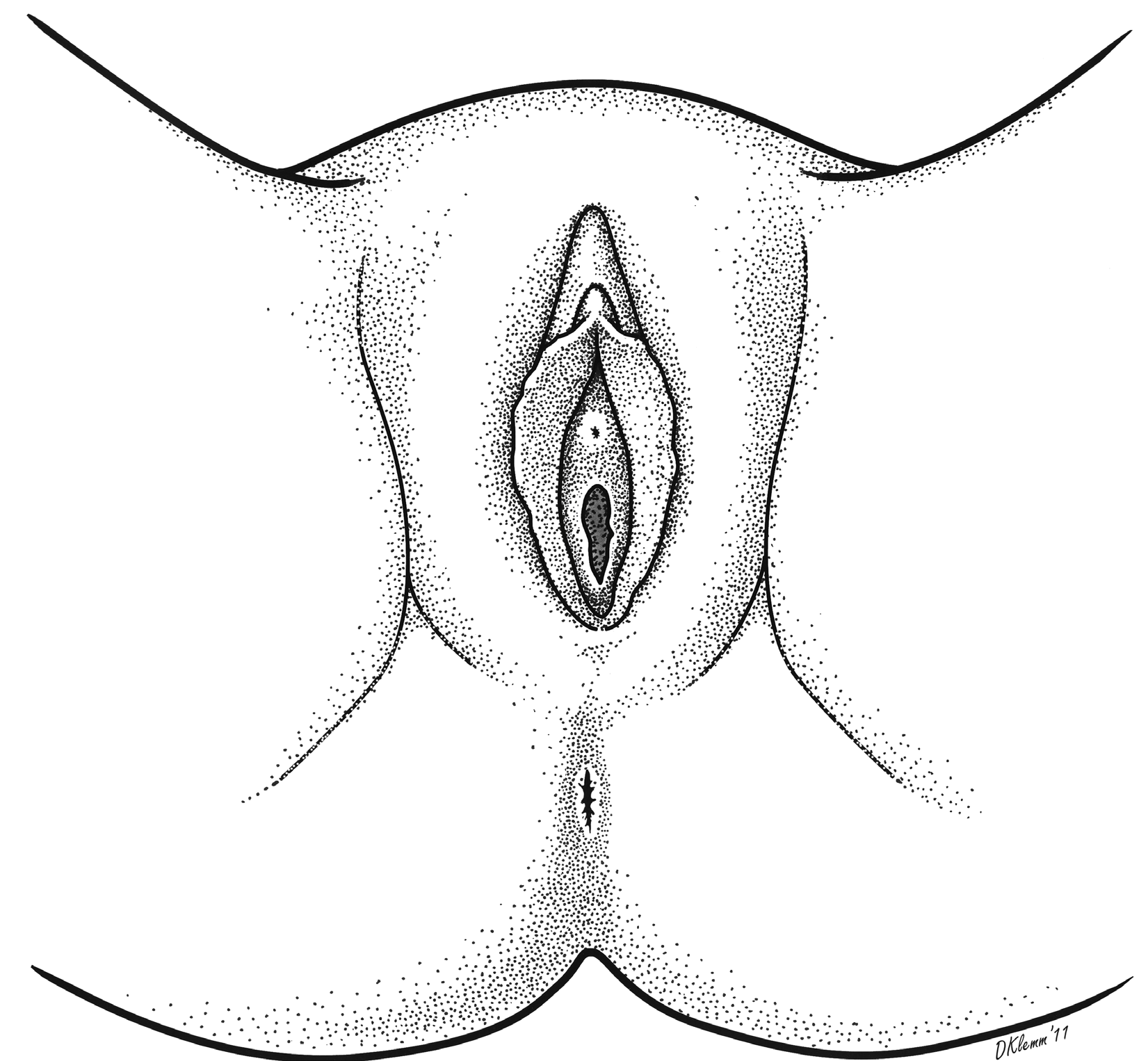 Sistema Reproductor Femenino: órganos genitales externos Labios