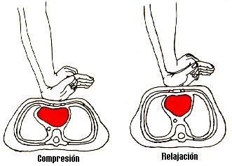 En caso de que el pulso se restablezca espontáneamente suspenda las maniobras de masaje cardíaco y continúe con las de respiración y repita el procedimiento hasta que entregue la víctima en un centro