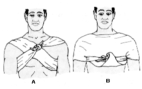 La venda triangular tiene múltiples usos, con ella se pueden realizar vendajes en diferentes partes del cuerpo