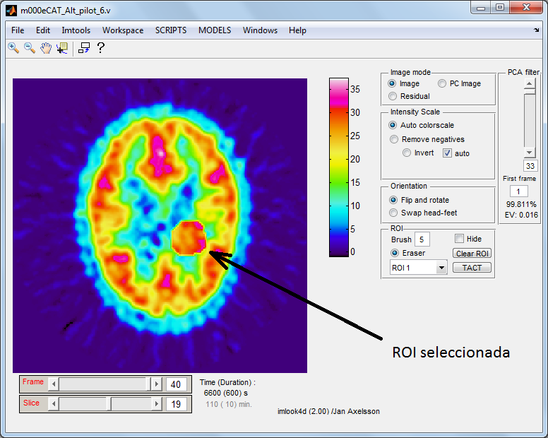 En la figura 7.3 se observa una captura de pantalla del programa. Figura 7.3: Captura de pantalla del ImLook4D. 7.2.2.3. MIA (Medical Image Analysis) Se encuentra disponible en [57].