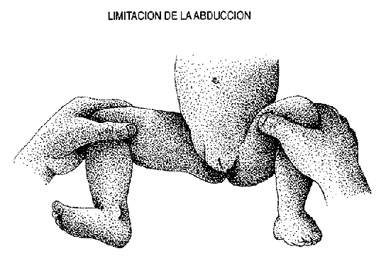 Caderas: abducción normal: las piernas rotan en 360 alrededor de la cadera sin limitación.