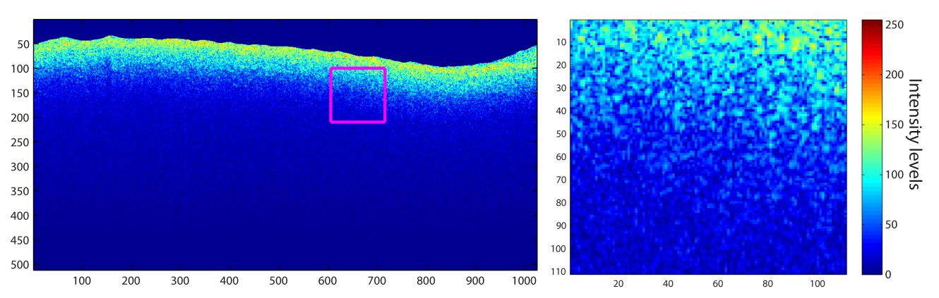 Figura 5.7 B-scans representados en falso color de intensidad de 8 bits. Superior: muestra sana. Inferior: muestra aneurismática. A la derecha se muestran regiónes agrandadas de 110 pixeles de lado.