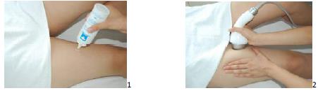 2. Tratamiento de las piernas Aplicar gel de enfriamiento por primera vez en la pierna (1), a continuación, iniciar las operaciones, utilizando el tratamiento apretar la pieza de mano con la mano en