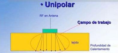 Electrodo Unipolar El electrodo Unipolar aplica la Radiofrecuencia de emisión sobre la zona de contacto con la piel.