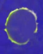 Identificación de Linfocito B por IF Observación, por microscopía de fluorescencia, de las