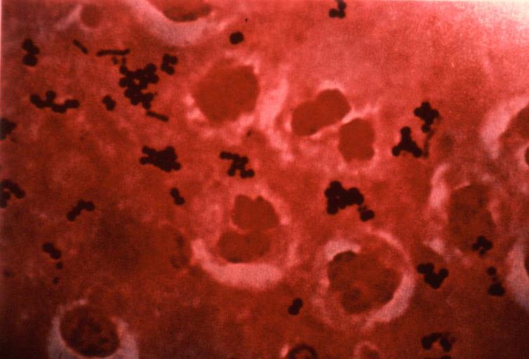 Staphylococcus áureas Microorganismos PATÓGENOS Bacteria presente en nuestra piel y la cavidad buconasal, una vez que llega al alimento produce una entero toxina que produce