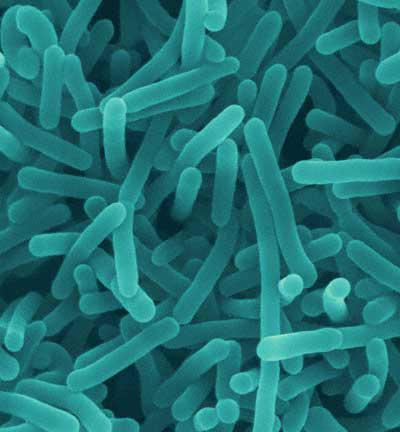 Listeria monocytogenes Microorganismos PATÓGENOS Bacteria