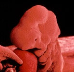 arcos braquiales y el oído interno. El tubo neural está abierto por arriba y por abajo, pero cerrado por el medio. 4 Semanas A las 4 ½ semanas el embrión ya mide unos 6mm.