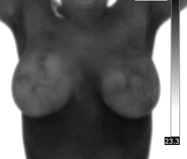 Olavarría [9]. Actualmente, está siendo evaluada la utilidad diagnóstica de los algoritmos para la detección de un conjunto de patologías mamarias.