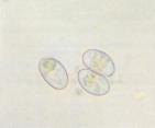 Protozoarios intestinales: Flagelados, ciliados y coccidios Figura A1.10. Quistes de Giardia lamblia, (lugol) Figura A1.11.