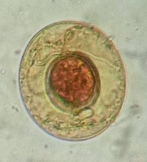 Helmintos: Platelmintos (céstodes),fasciola y Paramphistomum Figura A2.10. Huevo de Taenia sp., coloración lugol (200X) Figura A2.11. Huevo de Taenia sp. Solucion salinal (400X) Figura A2.