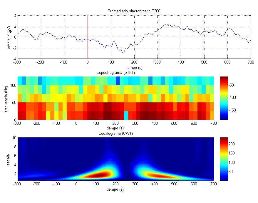 ANÁLISIS DE LA SEÑAL Y POTENCIALES EVOCADOS P300 Figura 3-11. En la figura superior, representación del promediado sincronizado de 90 épocas de P300 para un odd-ball auditivo.