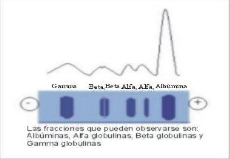 Clasificación 1. Albúmina 2. Alfa1-globulinas 3.