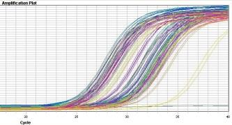 Algoritmo para Vigilancia por Laboratorio para EVE en InDRE Toma de muestra con menos de 7 días de evolución Recepción de muestras en InDRE Toma de 200 µl de suero.