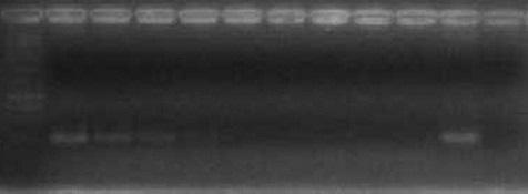 M 1 2 3 4 5 6 7 8 9 1330 pb 1150 pb 1300 pb Figura9. PCR de la proteasa de cisteíno. Evaluación de la sensibilidad con ADN extraído de formas de L (V.) braziliensis en buffer PBS.