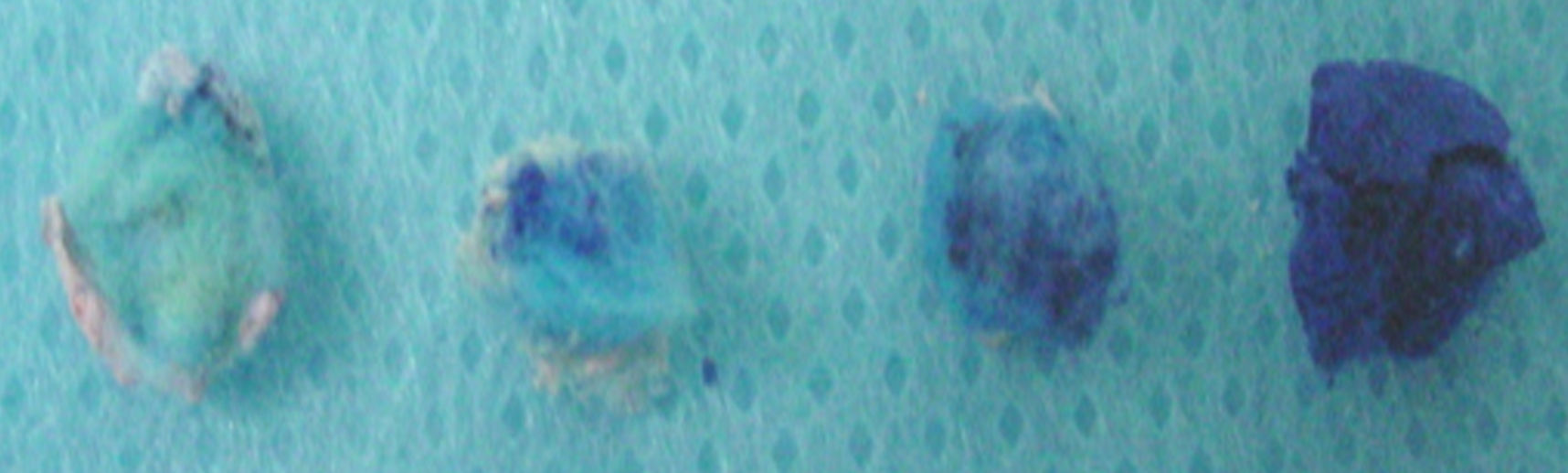 percha y cemento provisional y dejados inmersos en el colorante azul de metileno a 1%, en la estufa en una temperatura de 37º por 24 horas.