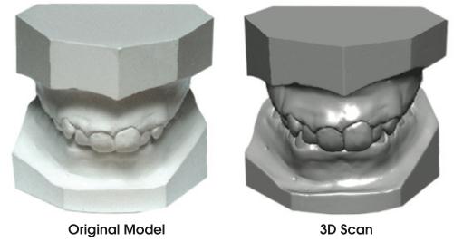 3.6.2 Modelos Digitales Tridimensionales Con los recientes avances en el desarrollo de sistemas digitales, tenemos la tecnología de los modelos de estudio digitales que permite al ortodoncista ver