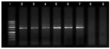 Evolución de las metodologías = Evolución de algoritmos 1985 1995 2005 2015 Aislamiento viral (15 días) RT-PCR punto