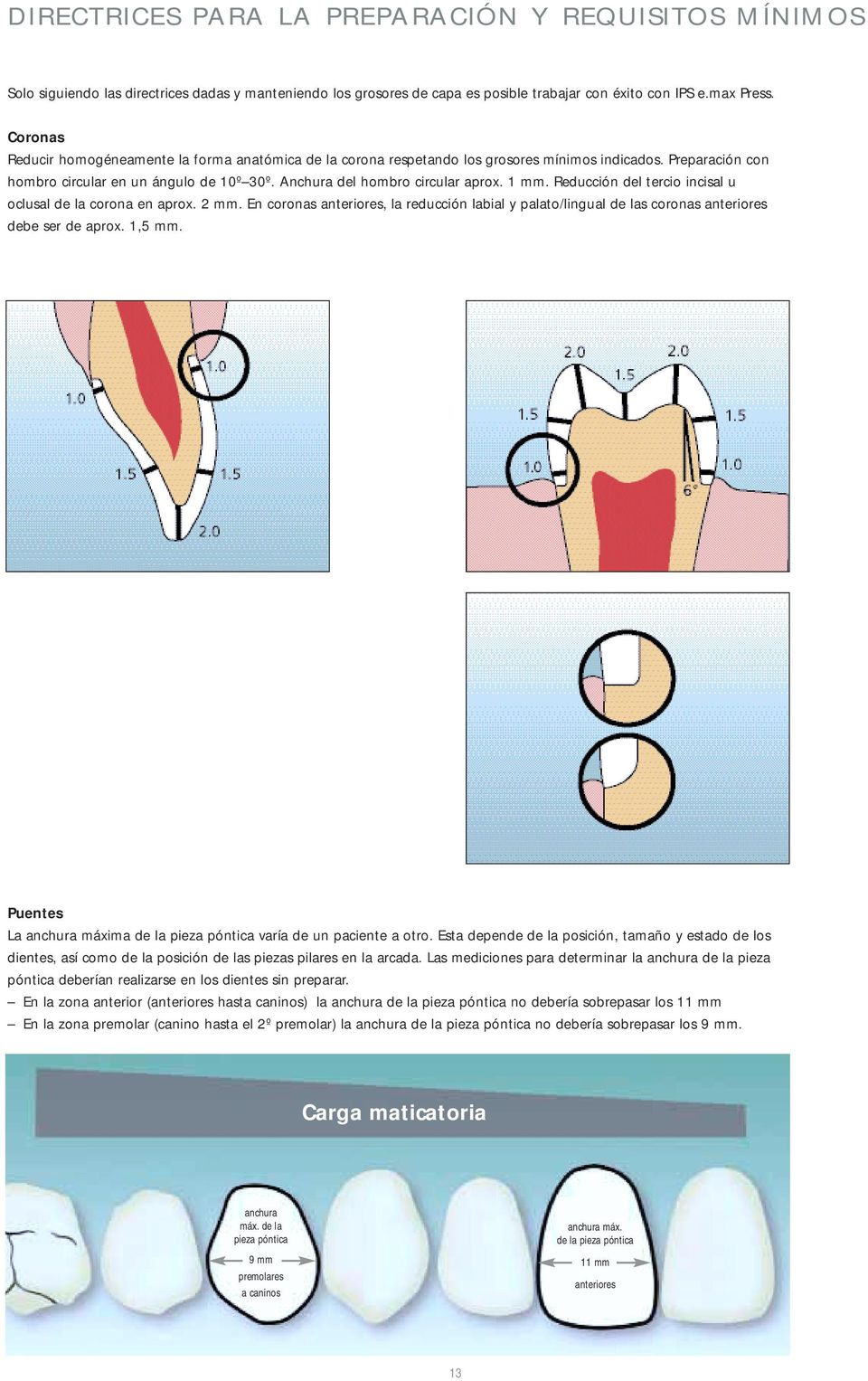 1 mm. Reducción del tercio incisal u oclusal de la corona en aprox. 2 mm. En coronas anteriores, la reducción labial y palato/lingual de las coronas anteriores debe ser de aprox. 1,5 mm.