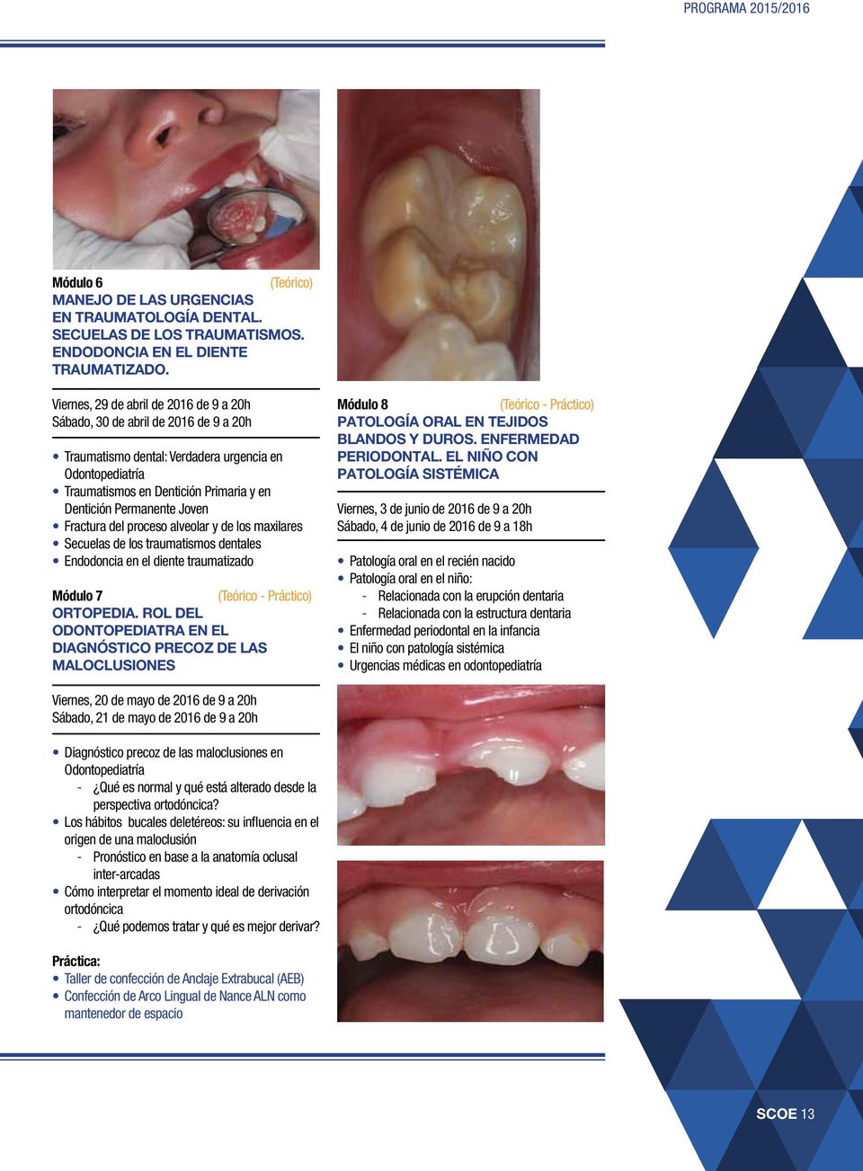 Joven Fractura del proceso alveolar y de los maxilares Secuelas de los traumatismos dentales Endodoncia en el diente traumatizado Módulo 7 ORTOPEDIA.