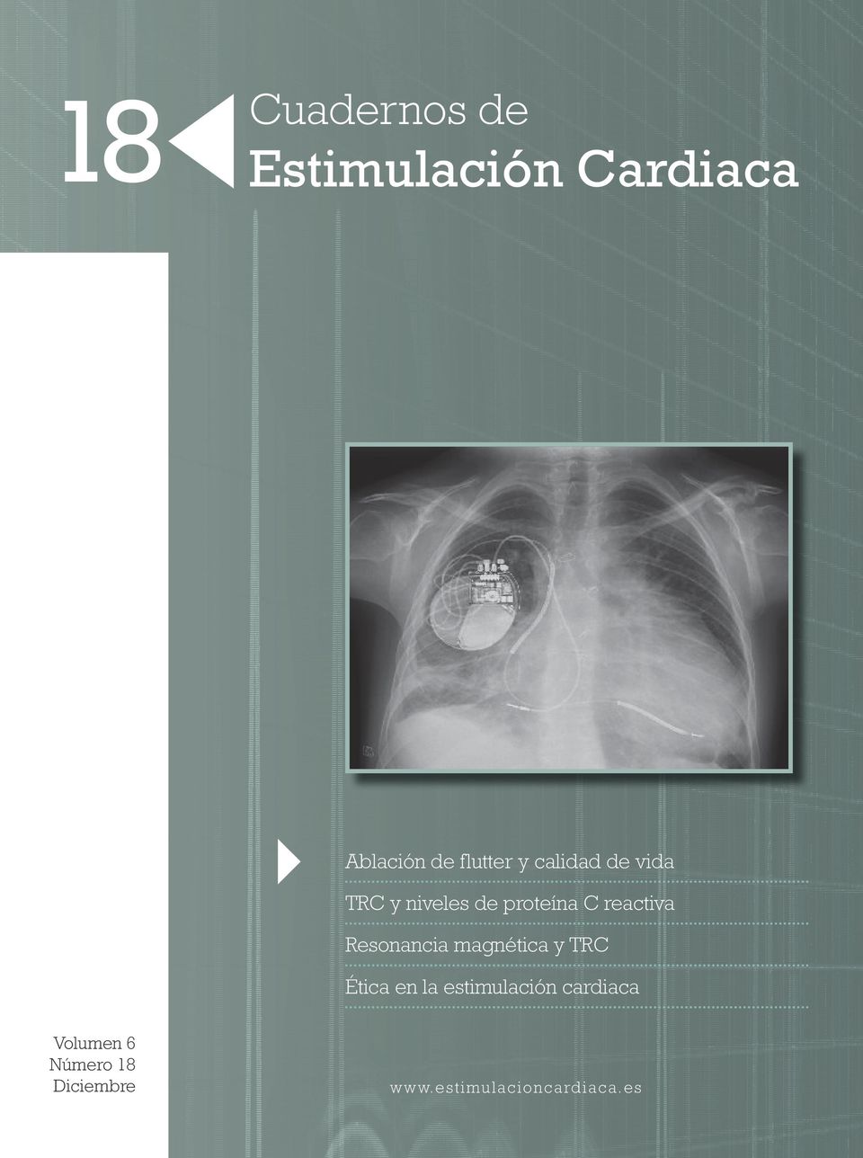 Resonancia magnética y TRC Ética en la estimulación cardiaca