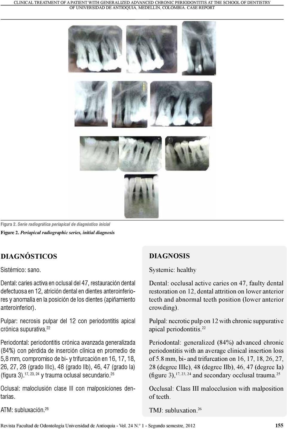 Dental: caries activa en oclusal del 47, restauración dental defectuosa en 12, atrición dental en dientes anteroinferiores y anomalía en la posición de los dientes (apiñamiento anteroinferior).