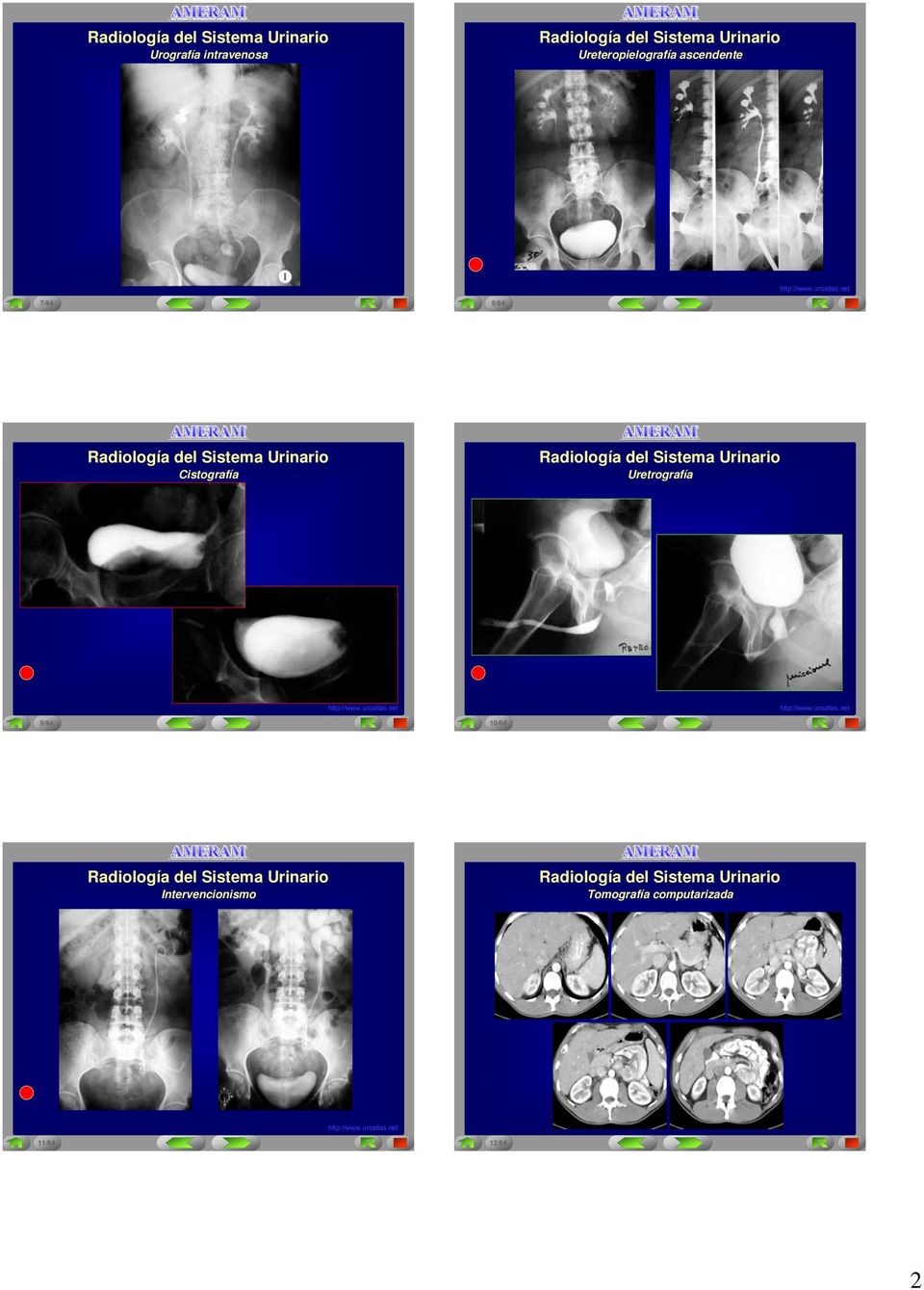 para para la la la la Enseñanza de de Radiología a a Alumnos Alumnos de de de Urografía intravenosa