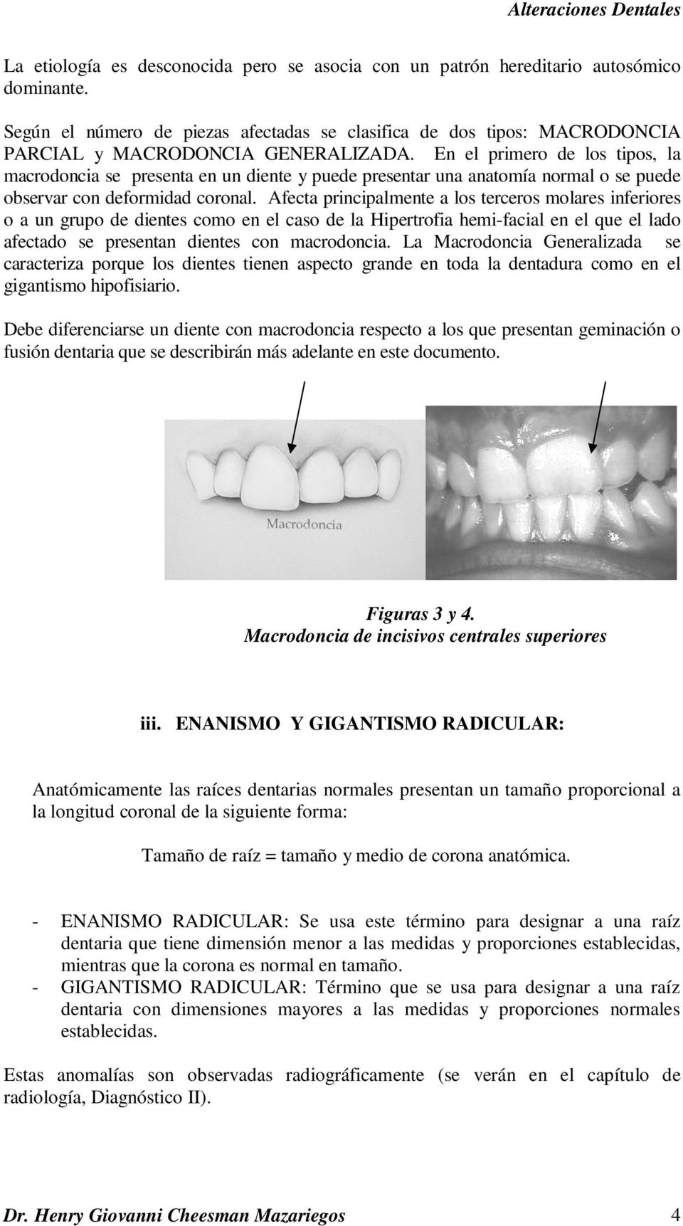 En el primero de los tipos, la macrodoncia se presenta en un diente y puede presentar una anatomía normal o se puede observar con deformidad coronal.