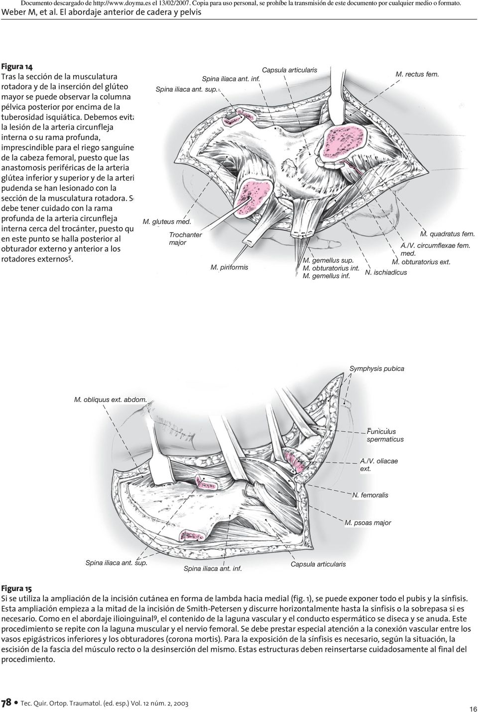 inferior y superior y de la arteria pudenda se han lesionado con la sección de la musculatura rotadora.