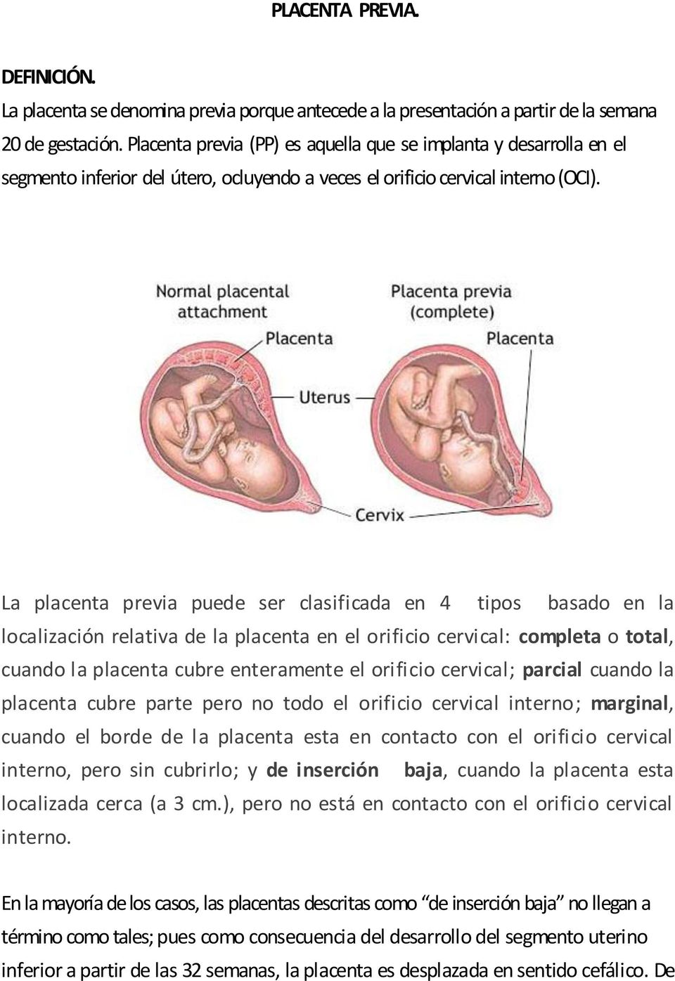 La placenta previa puede ser clasificada en 4 tipos basado en la localización relativa de la placenta en el orificio cervical: completa o total, cuando la placenta cubre enteramente el orificio
