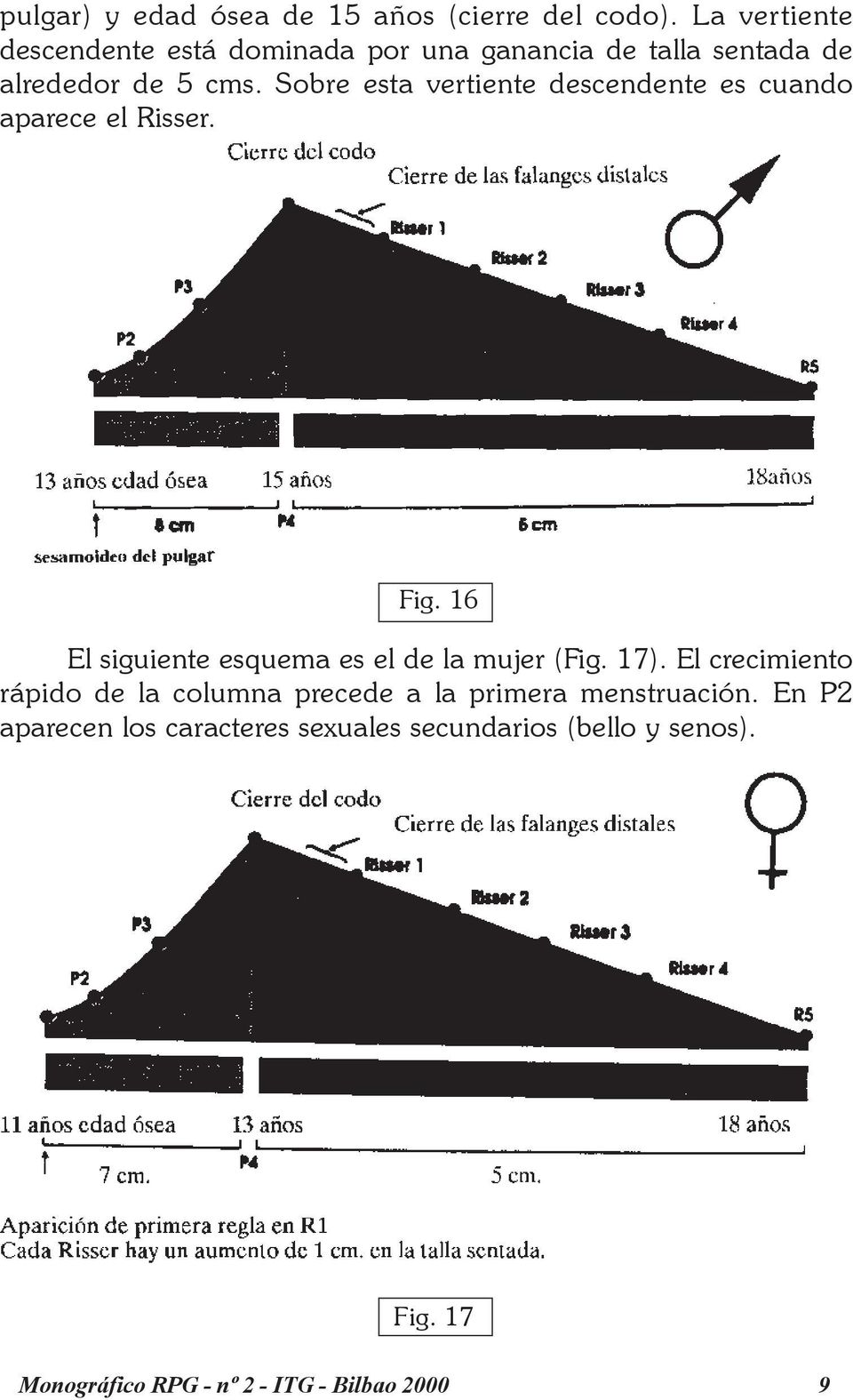 Sobre esta vertiente descendente es cuando aparece el Risser. Fig. 16 El siguiente esquema es el de la mujer (Fig.