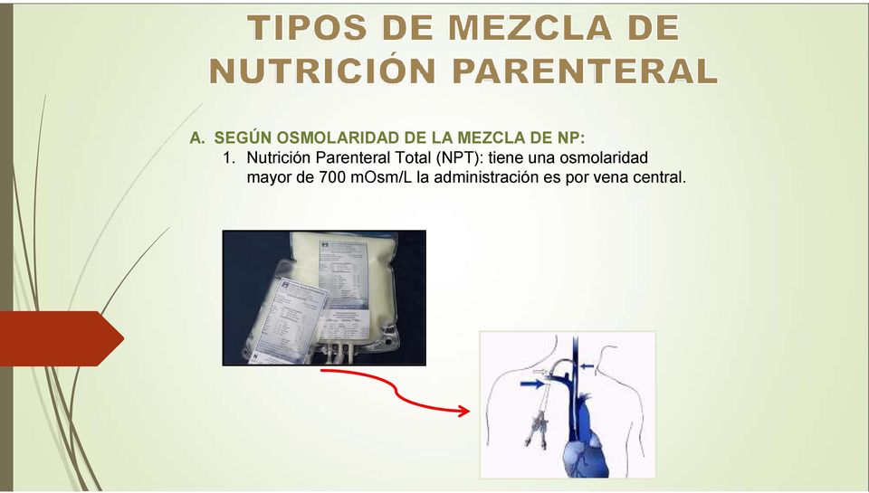 Nutrición Parenteral Total (NPT): tiene