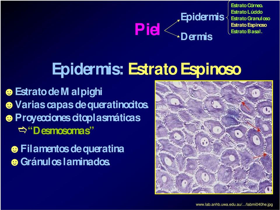 Epidermis: Estrato Espinoso Estrato de Malpighi Varias capas de