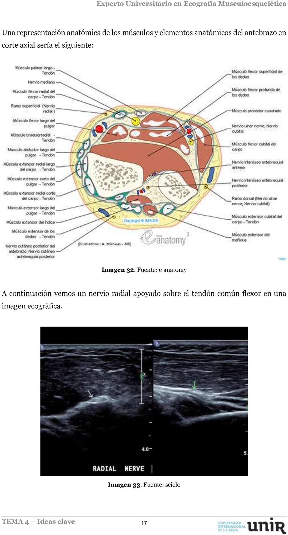 Fuente: e anatomy A continuación vemos un nervio radial apoyado