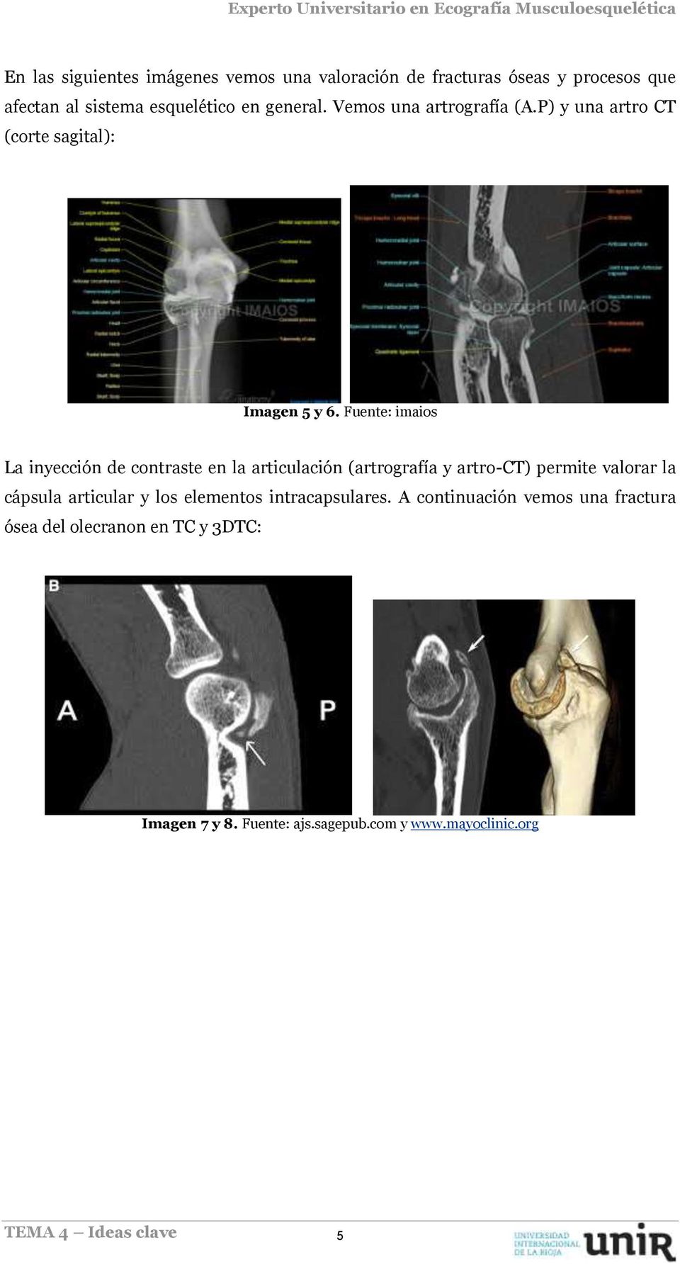 Fuente: imaios La inyección de contraste en la articulación (artrografía y artro-ct) permite valorar la cápsula