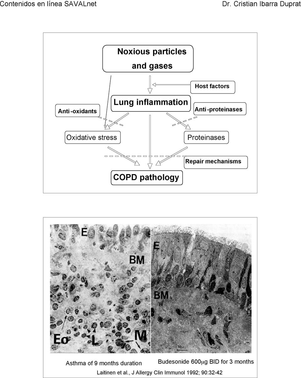mechanisms COPD pathology Asthma of 9 months duration Budesonide