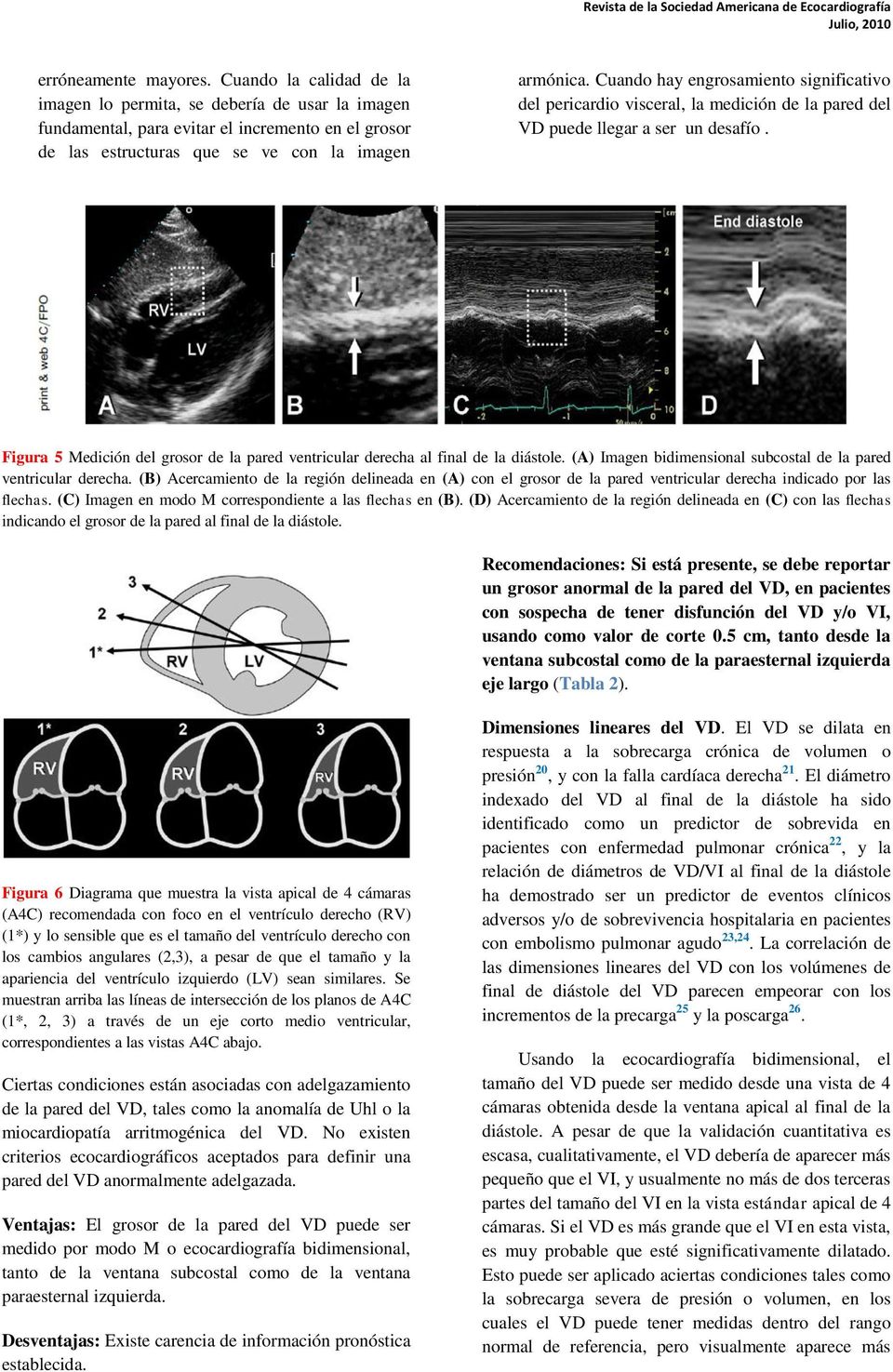 Figura 5 Medición del grosor de la pared ventricular derecha al final de la diástole. (A) Imagen bidimensional subcostal de la pared ventricular derecha.