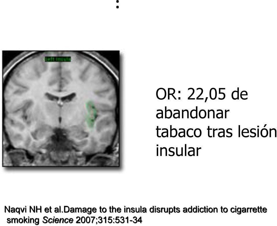 damage to the insula disrupts