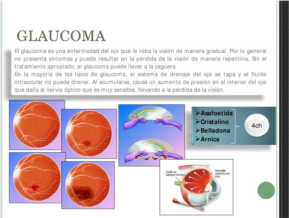 Sin el tratamiento apropiado, el glaucoma puede llevar a la ceguera En la mayoría de los tipos de glaucoma, el sistema de drenaje del ojo se