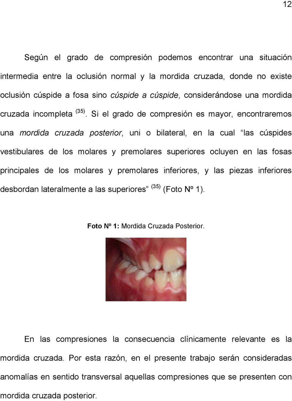Si el grado de compresión es mayor, encontraremos una mordida cruzada posterior, uni o bilateral, en la cual las cúspides vestibulares de los molares y premolares superiores ocluyen en las fosas