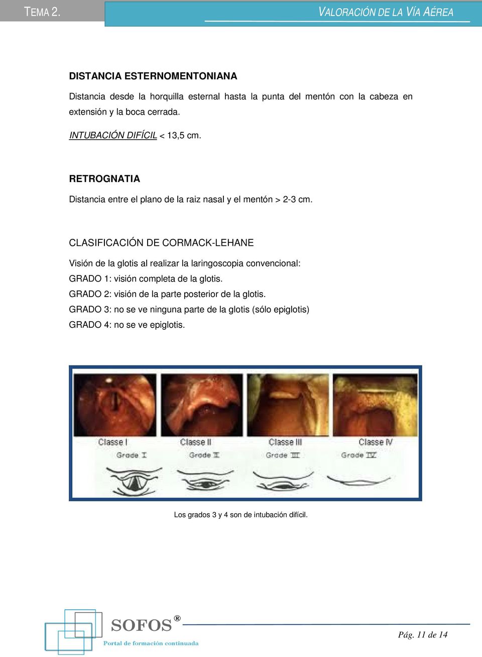 CLASIFICACIÓN DE CORMACK-LEHANE Visión de la glotis al realizar la laringoscopia convencional: GRADO 1: visión completa de la glotis.