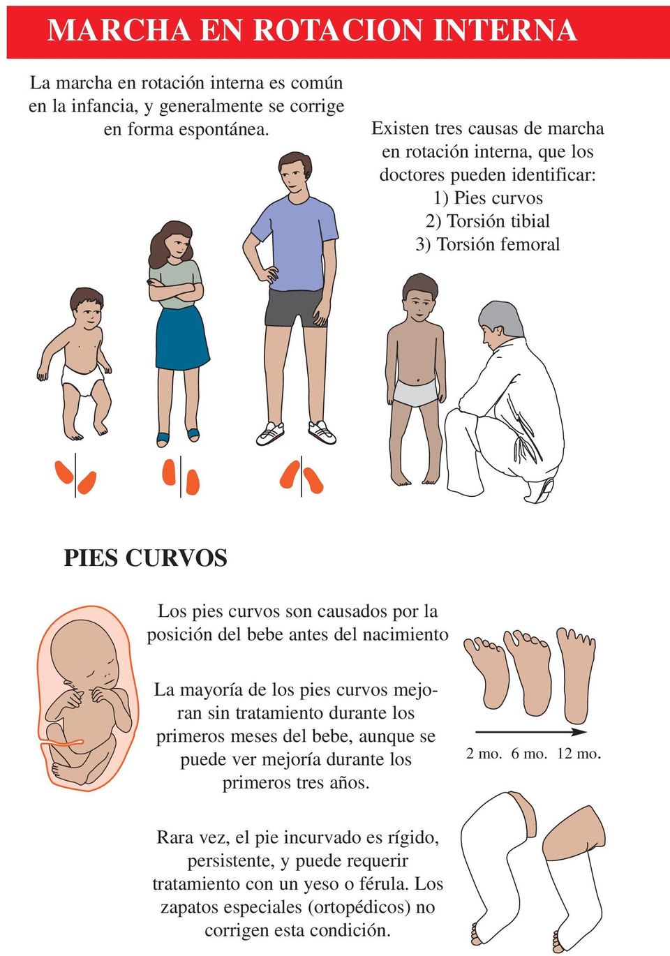 causados por la posición del bebe antes del nacimiento La mayoría de los pies curvos mejoran sin tratamiento durante los primeros meses del bebe, aunque se puede ver