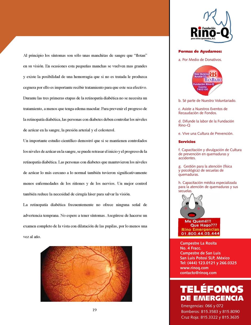 Durante las tres primeras etapas de la retinopatía diabética no se necesita un tratamiento, a menos que tenga edema macular.