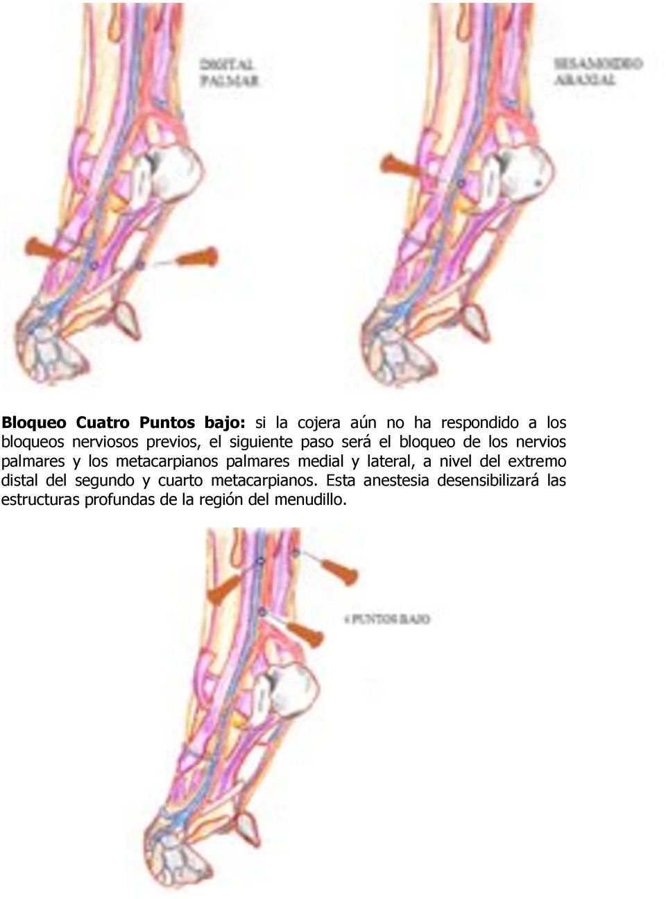 palmares medial y lateral, a nivel del extremo distal del segundo y cuarto