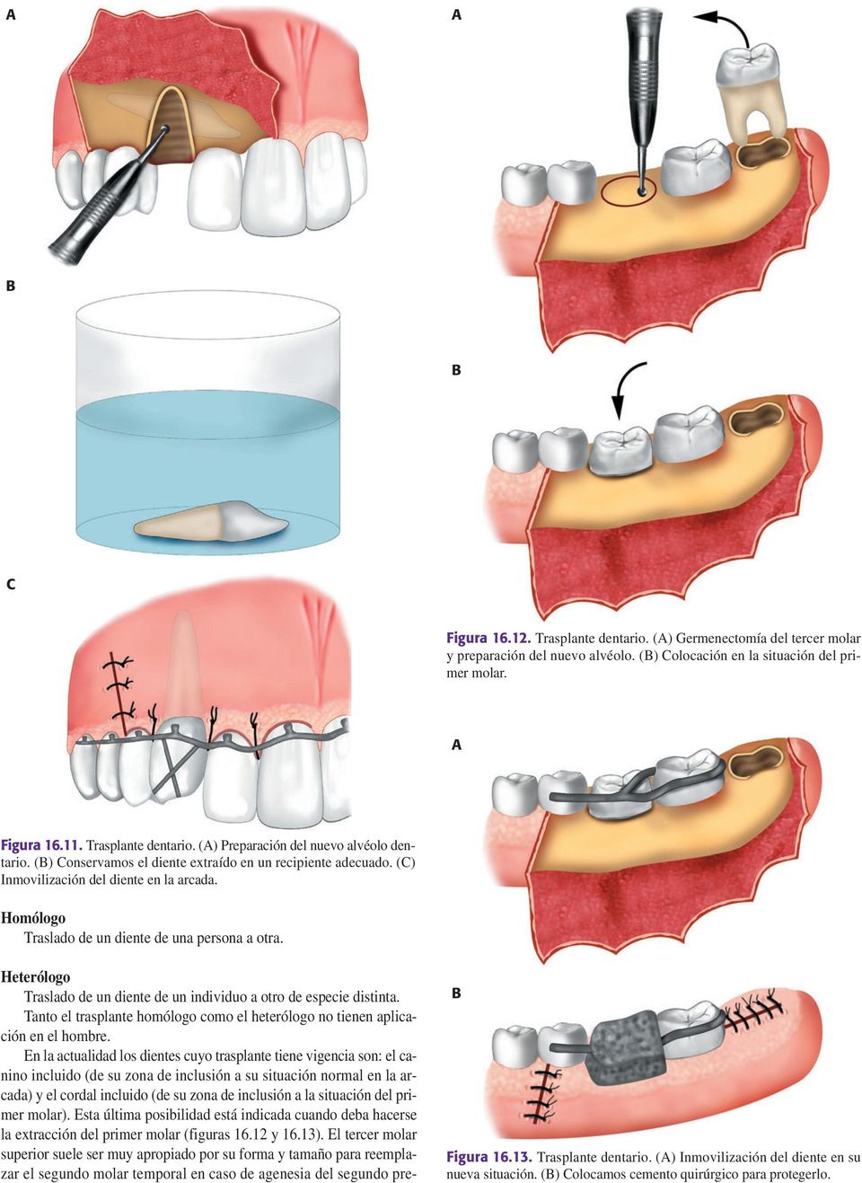 Heterólogo Traslado de un diente de un individuo a otro de especie distinta. Tanto el trasplante homólogo como el heterólogo no tienen aplicación en el hombre.